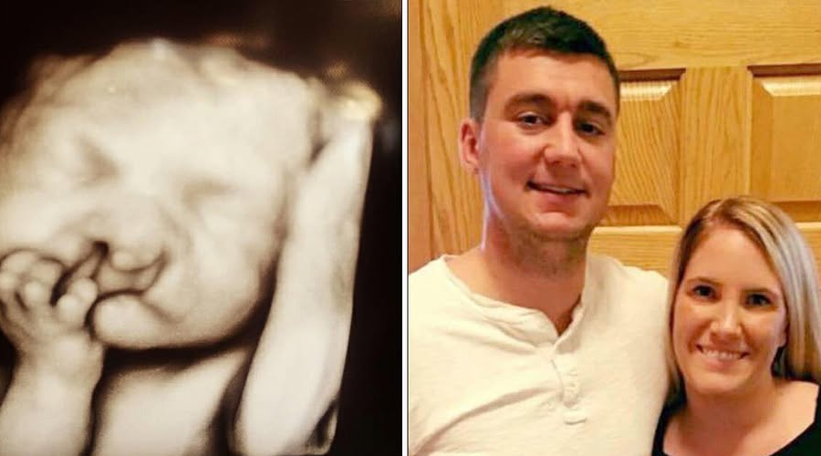 Parents refuse to terminate the pregnancy with the “malformed” baby – this is what the 2-year-old looks like now