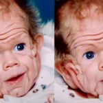 In 1993, This Boy Was Born With Enough Skin For A Five-Year-Old. But Wait Till You See Him Today