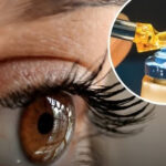 Multiple people have vision restored after world’s first stem cell transplant