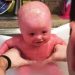 Doctors carry out an emergency C-section – then panic when baby’s face starts to change