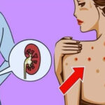 Kidneys: 10 signs they are failing