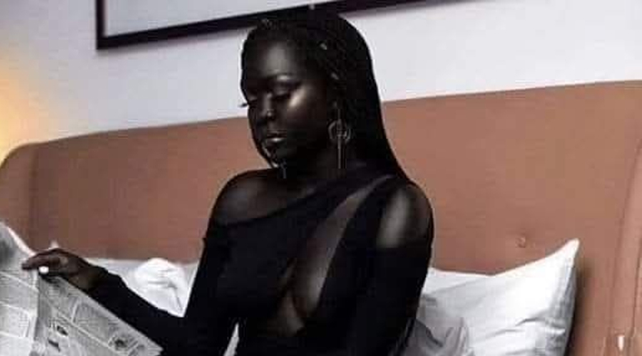 Embracing Darkness: Nyakim Gatwech’s Journey to Self-Love