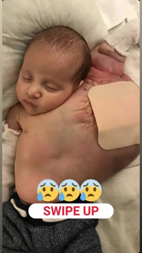 My baby son was born with a cyst the size of a football under his arm
