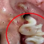 10 Early Signs of Health Problems You Shouldn’t Ignore