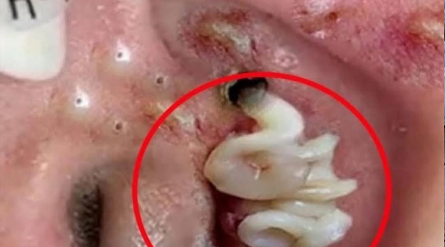 10 Early Signs of Health Problems You Shouldn’t Ignore