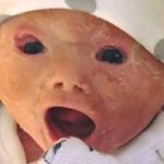 Mom shocked by her baby after birth, her words now spread like forest fire!