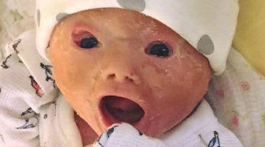 Mom shocked by her baby after birth, her words now spread like forest fire!