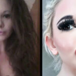 24-year-old woman wants the biggest lips in the world